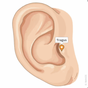 Anatomical illustration of human ear with labeled pin above the tragus. 