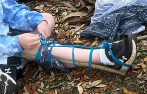 wilderness traction splint showing the lower leg 