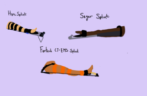 Three types of femur traction splints